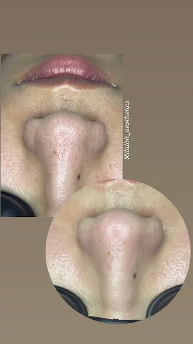 Dalbit Aesthetics Picture 5