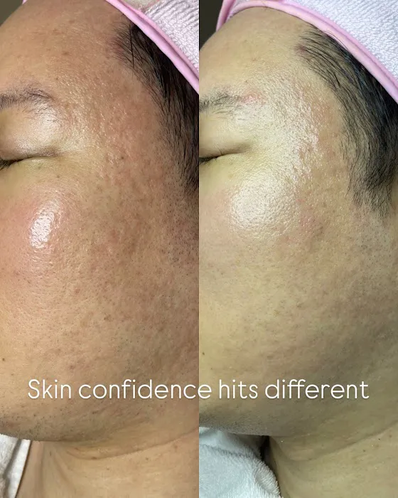 Dalbit Aesthetics Picture 7