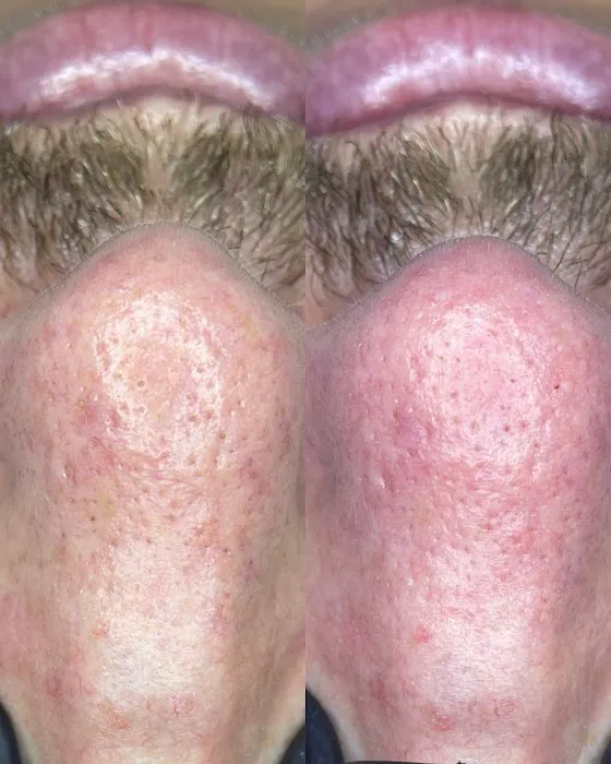 Dalbit Aesthetics Picture 6