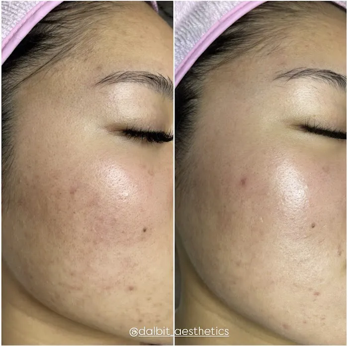 Dalbit Aesthetics Picture 8