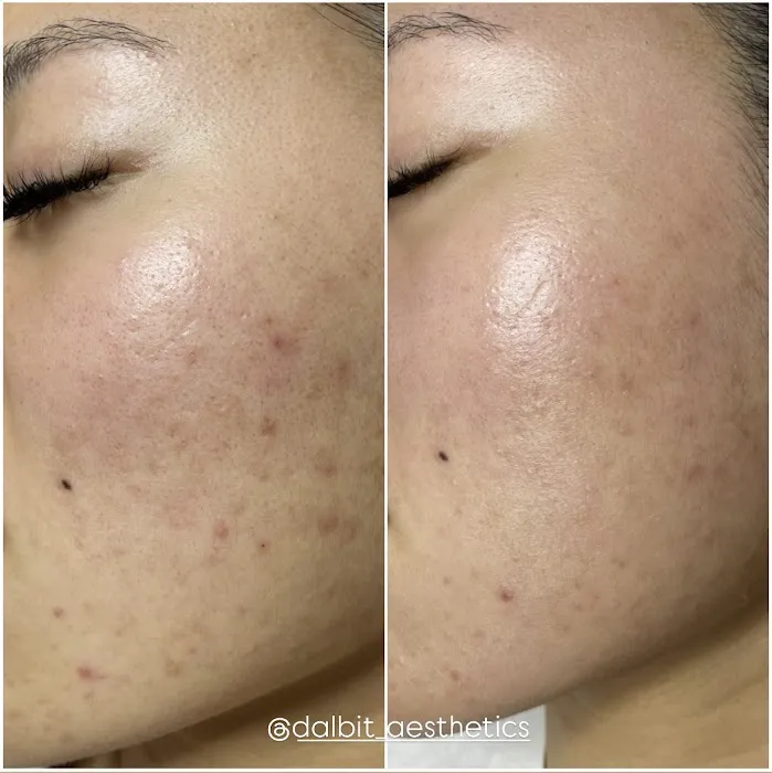 Dalbit Aesthetics Picture 10