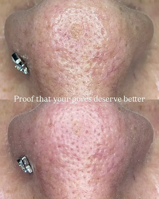 Dalbit Aesthetics Picture 9