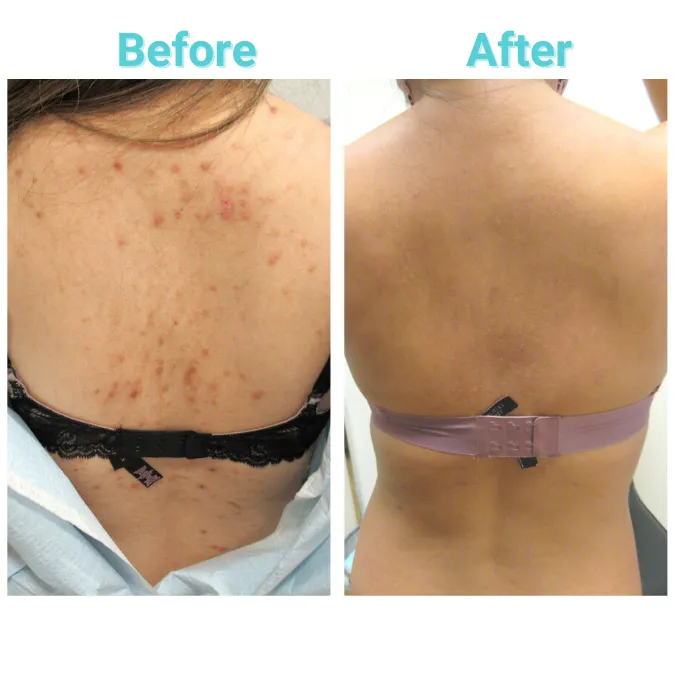 Array Skin Therapy Picture 4