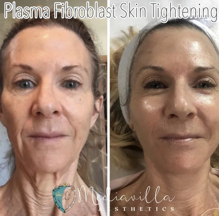 Mediavilla Aesthetics - KM Skin Studio Picture 5