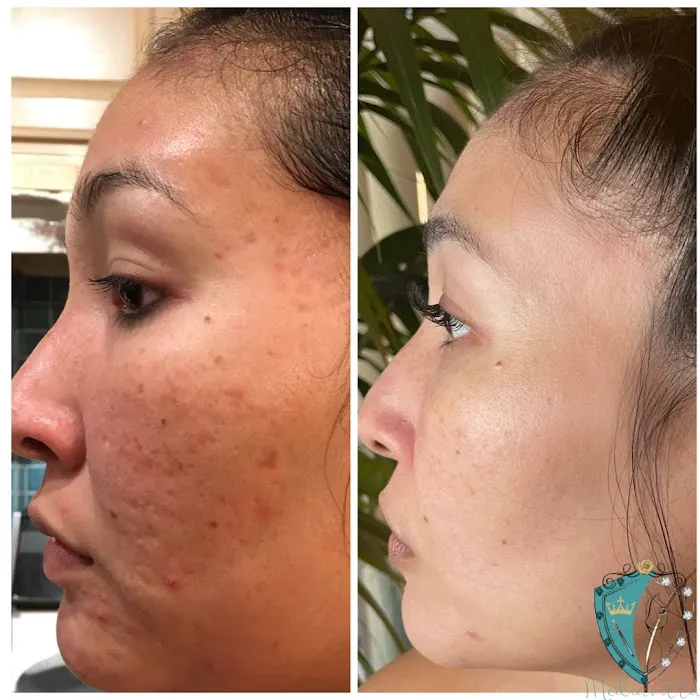 Mediavilla Aesthetics - KM Skin Studio Picture 6