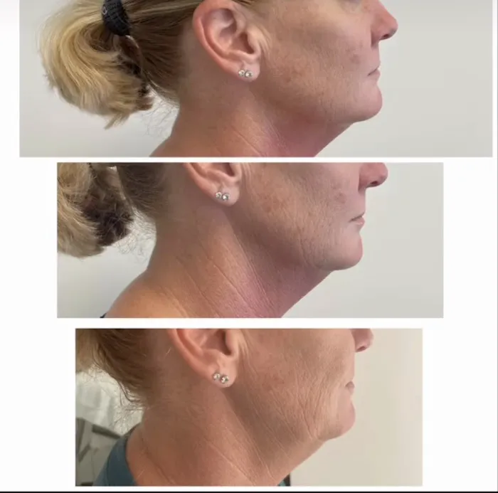 Mediavilla Aesthetics - KM Skin Studio Picture 7