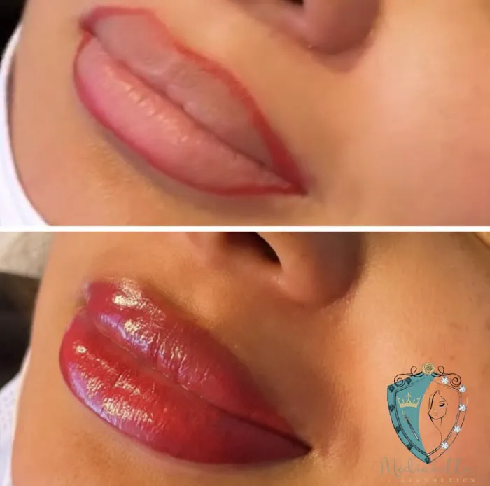 Mediavilla Aesthetics - KM Skin Studio Picture 8