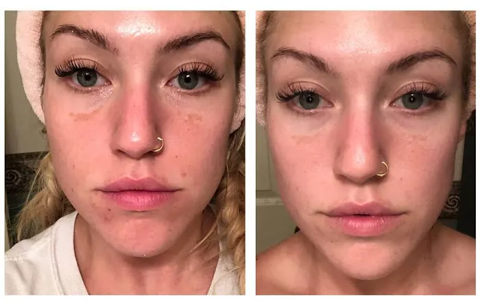 Youphoria skin studio Picture 7