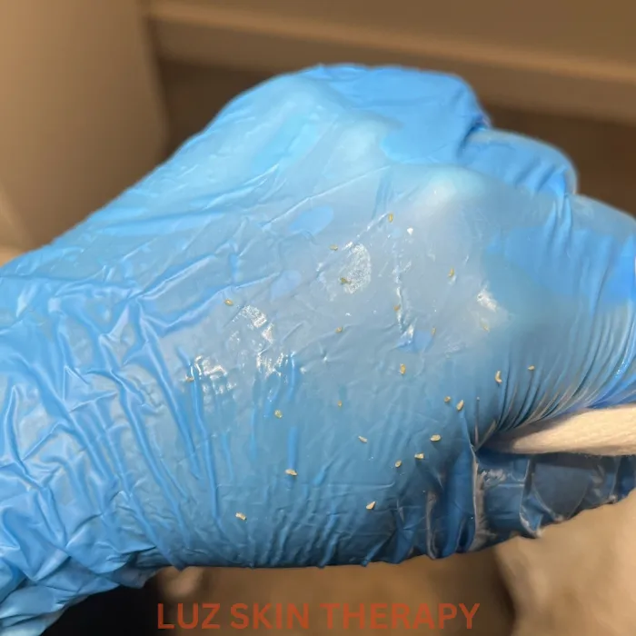 Luz Skin Therapy Picture 4