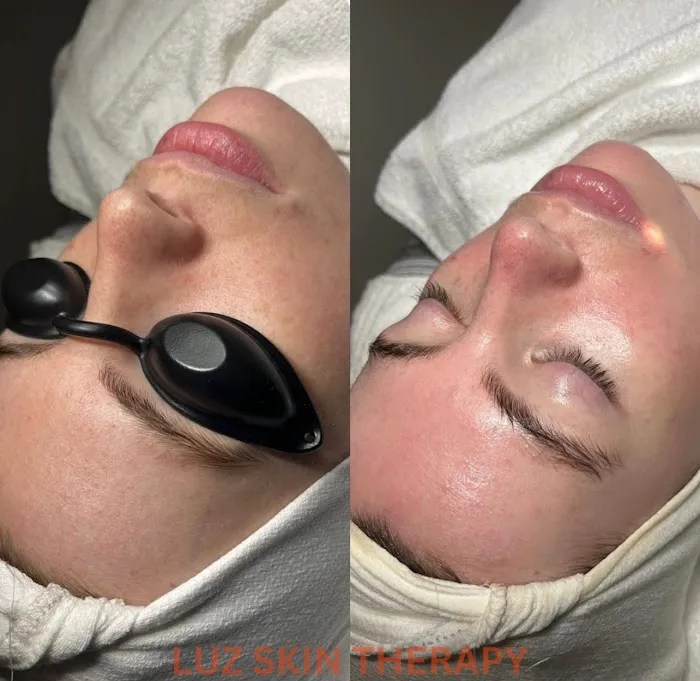 Luz Skin Therapy Picture 7