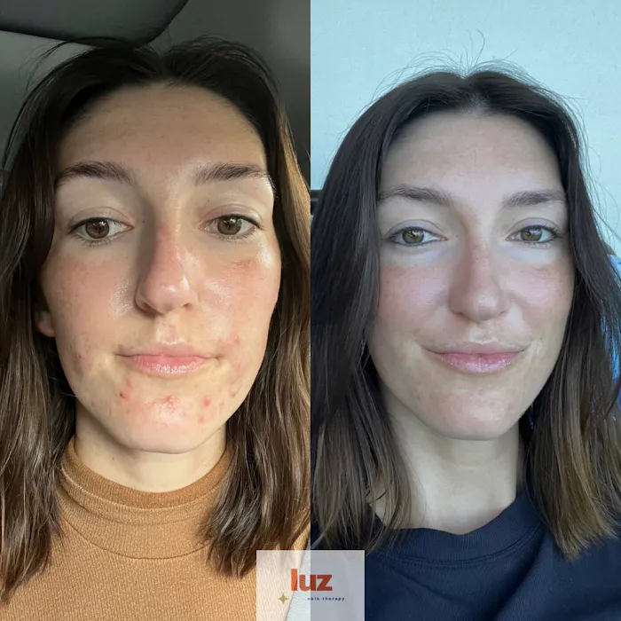 Luz Skin Therapy Picture 6