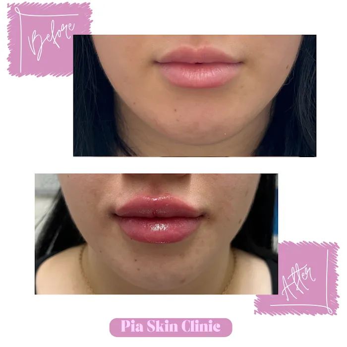 Pia Skin Clinic Picture 3