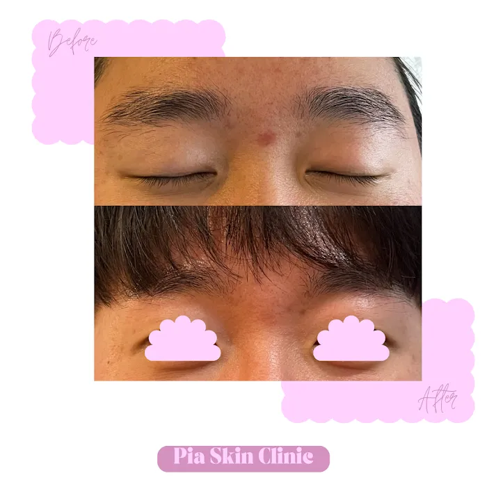 Pia Skin Clinic Picture 5