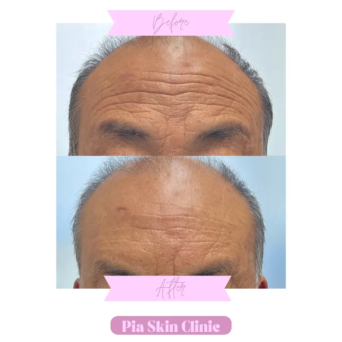 Pia Skin Clinic Picture 4