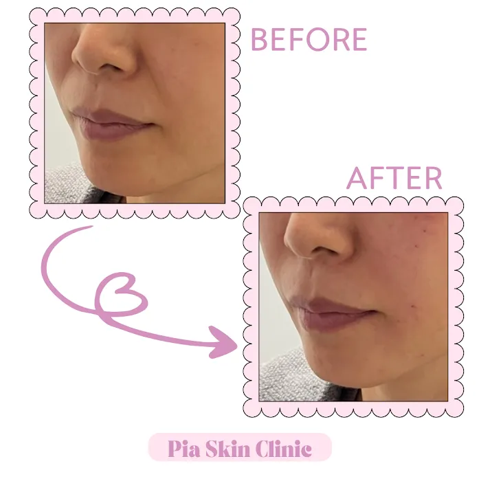 Pia Skin Clinic Picture 6