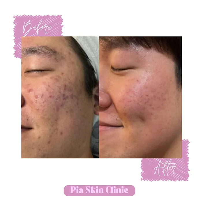 Pia Skin Clinic Picture 7