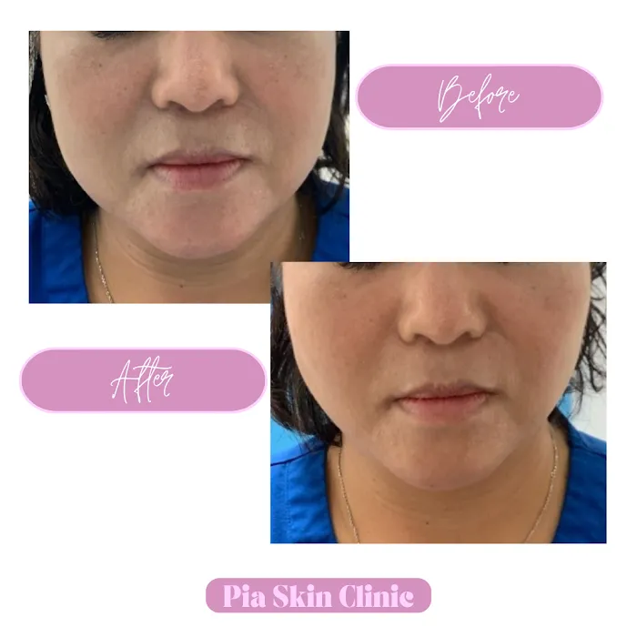 Pia Skin Clinic Picture 9