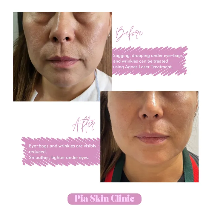 Pia Skin Clinic Picture 10