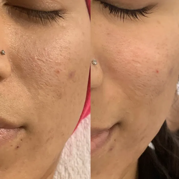 Lash & Brow LA Picture 7