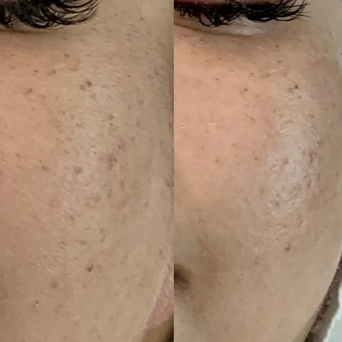 Lash & Brow LA Picture 10