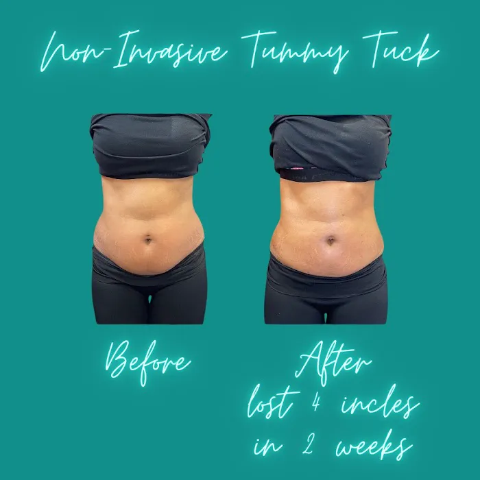 Tay Milz Aesthetics Picture 8