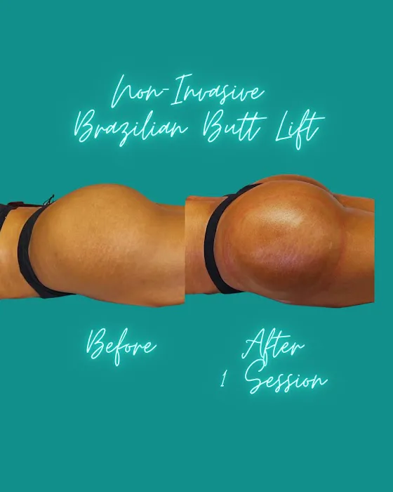 Tay Milz Aesthetics Picture 9