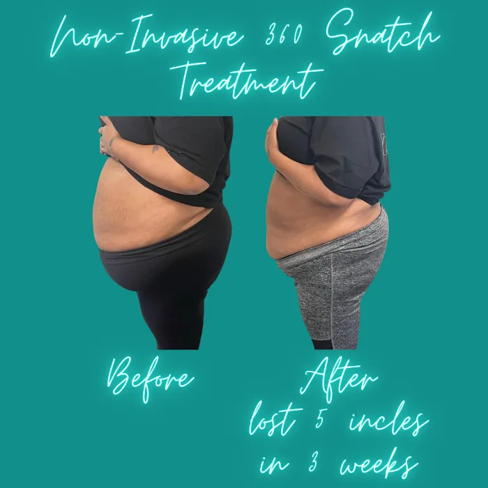 Tay Milz Aesthetics Picture 10