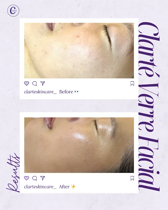 Clarte Skincare Picture 6