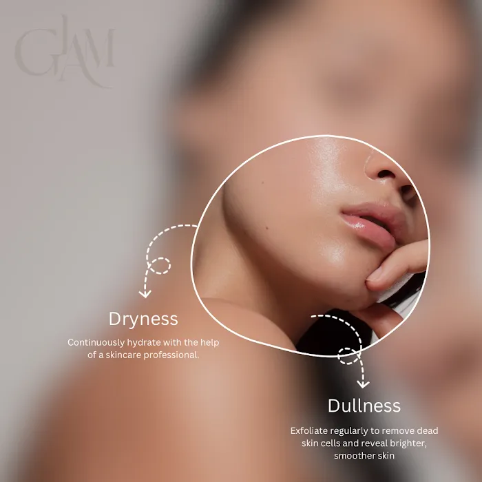 GLAM BEAUTY Picture 9