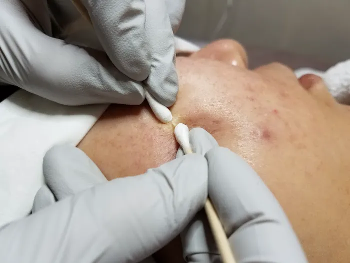 GLAM BEAUTY Picture 8