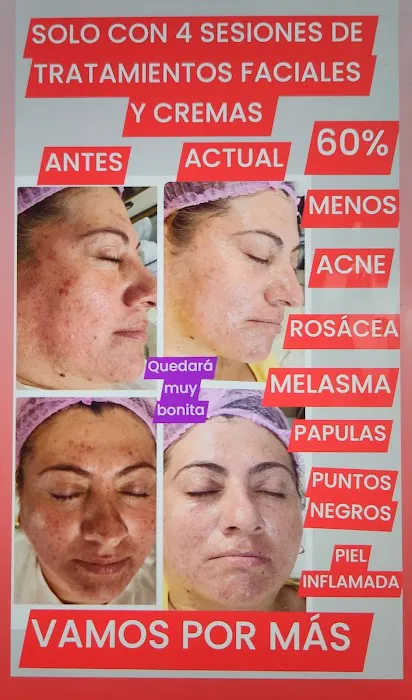 Centro Estetico Lucy Vargas Picture 4