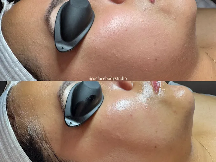 OC Face & Body Studio Picture 3