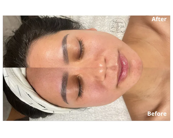 Beluminous Skin Studio Picture 9