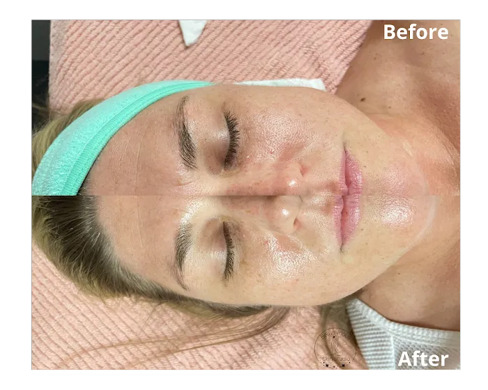 Beluminous Skin Studio Picture 10