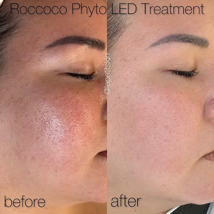 Le Petit Skin Picture 4