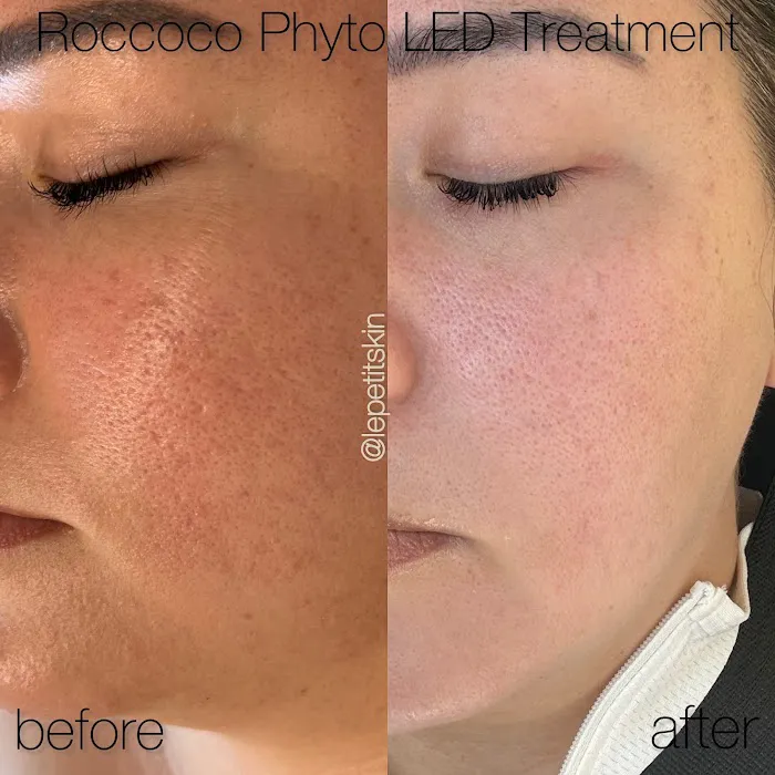 Le Petit Skin Picture 5