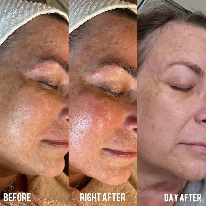 Le Petit Skin Picture 7