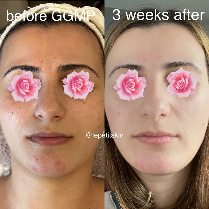 Le Petit Skin Picture 8