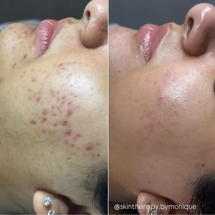 Skintherapy by Monique Picture 6