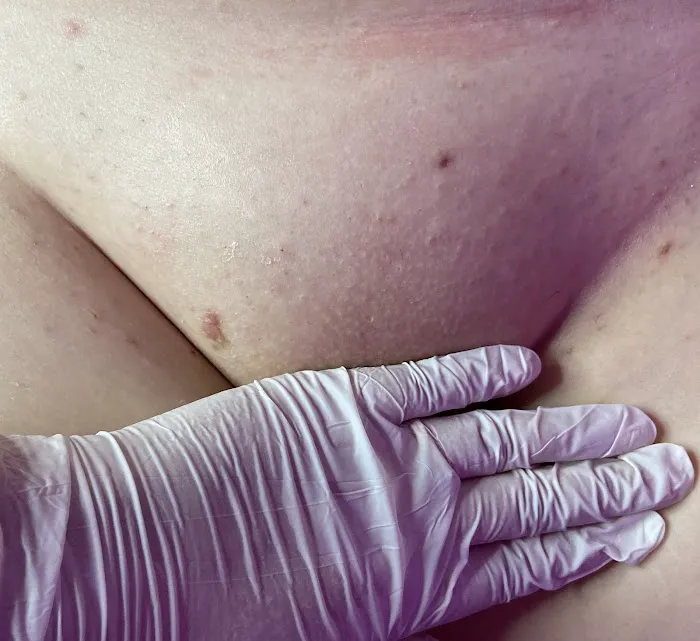 Resurrected Beauty Picture 1