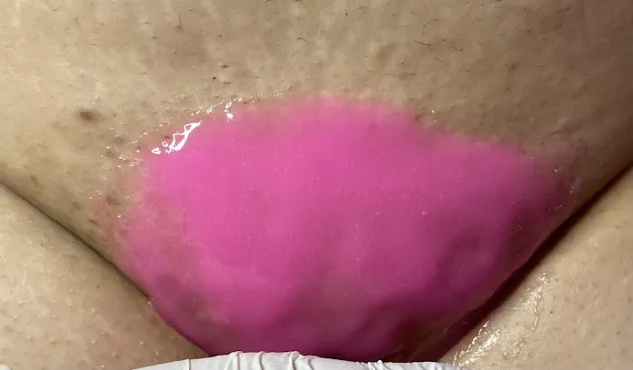 Resurrected Beauty Picture 6