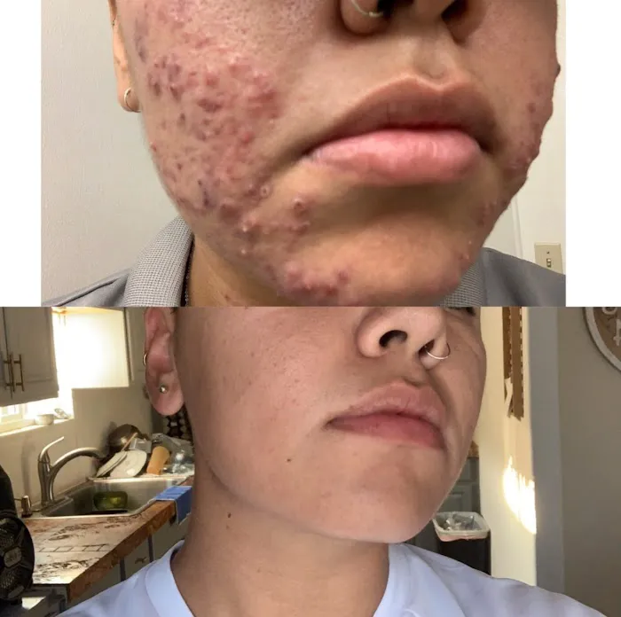 Daisy MD Care Picture 2