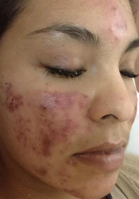 Daisy MD Care Picture 5