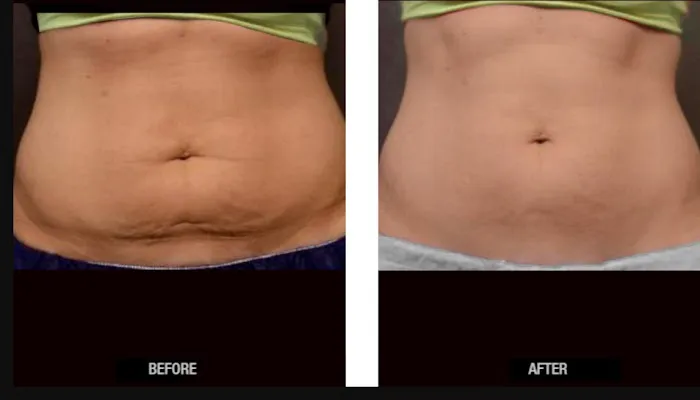 Balance Beauty and Health Picture 6