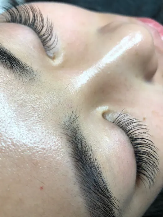 Shine Skin Care Picture 8