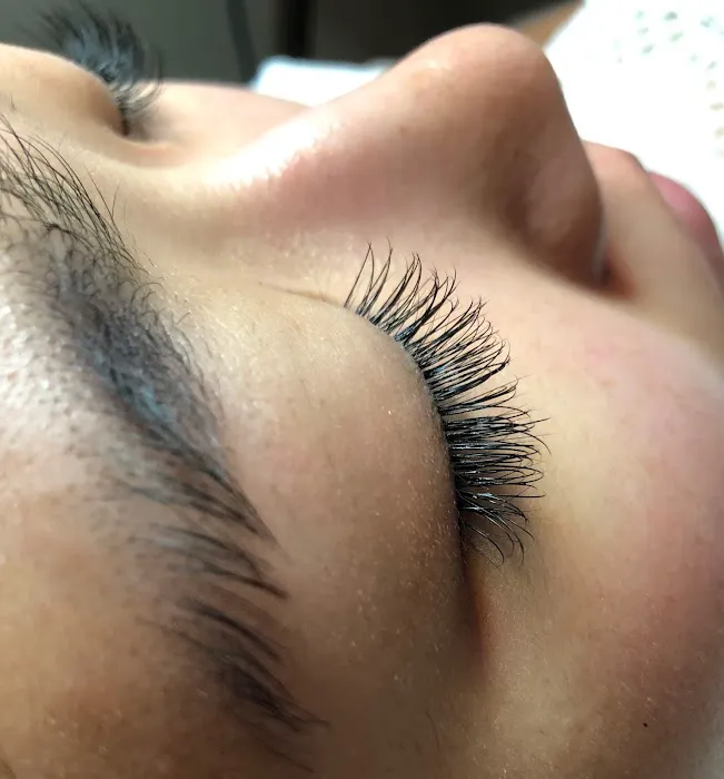 Shine Skin Care Picture 10