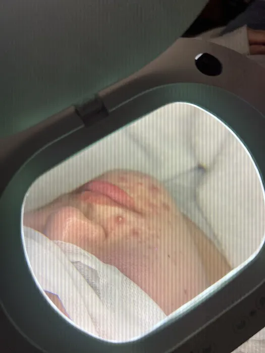 Clear Skin Solutions Picture 5