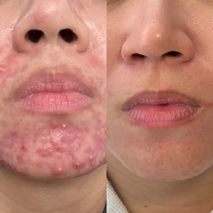 Clear Skin Solutions Picture 10