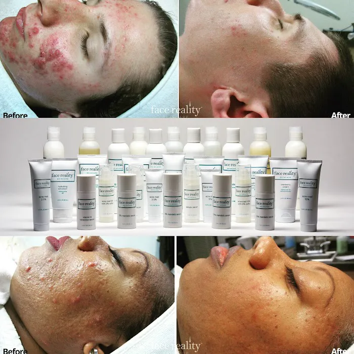 Clear Skin Solutions Picture 9