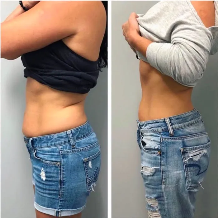 Evolve wellness center Picture 4